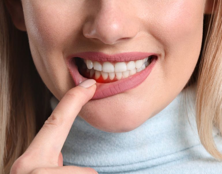 7-tips-for-maintaining-healthy-gums-and-teeth