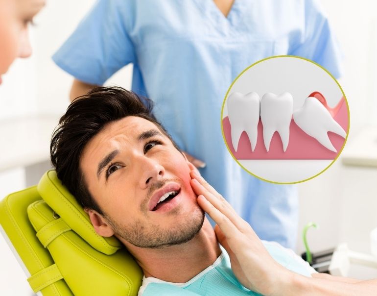 What's Causing Wisdom Teeth Infections